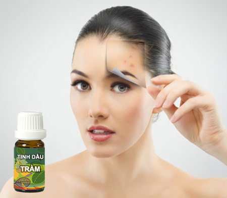 tinh-dầu-tràm-trị-mụn
